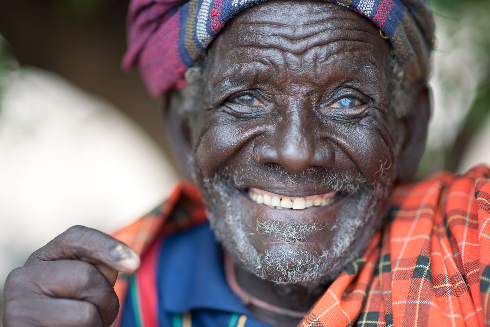 Arbore tribal elder with cataracts